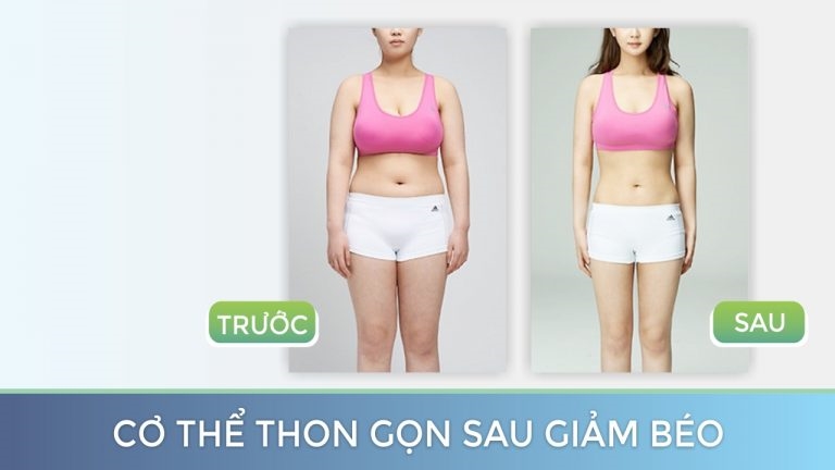 Hình ảnh sau khi sử dụng giảm mỡ nhanh công nghệ cao