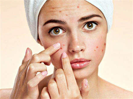 Trị mụn mùa hè giảm sốc: 300.000 đồng