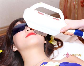 Những điều cần biết khi triệt lông